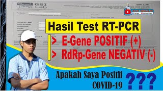 Cara Membaca Hasil Tes RTPCR Corona PCR real Times  RdRp gene Positif N gene Positif [upl. by Clyte]