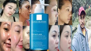 la roche posay effaclar purifying foaming gel  honest review [upl. by Janik]