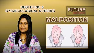 FETAL MALPOSITIONDHANYA DEEPUHIGH RISK LABOUR [upl. by Ardnasak893]