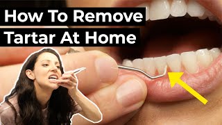 Is it Possible To Remove Tartar At Home [upl. by Copp]