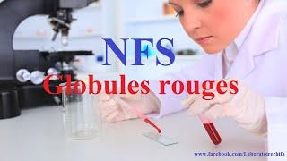 NFS Globules rouges [upl. by Eadahs344]