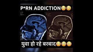 PORN addiction damage your health😳🤔 information knowledge porn addiction shorts viral [upl. by Danaher712]