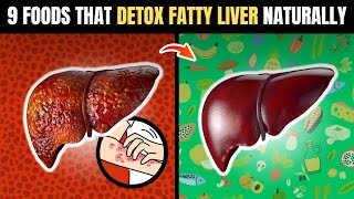 9 Best Foods That DETOX Fatty Liver Naturally And Foods to Avoid [upl. by Strephon]