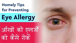 Eye Allergy Treatment Easy tips from Eye surgeon to manage Eye Allergy आंखों में जलन का आसान इलाज [upl. by Rimidalb]