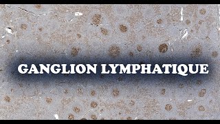 GANGLION LYMPHATIQUE profil immuno 2  HISTOLOGIE [upl. by Eelrebmyk]