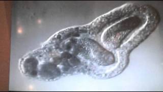 Amoeba eats two paramecia Amoebas lunch [upl. by Retepnhoj]