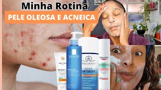 PRODUTOS QUE USO PARA CONTROLAR A OLEOSIDADE CLAREAR MANCHAS DE ACNE E DIMINUIR CRAVOS E ESPINHAS [upl. by Lorrac]