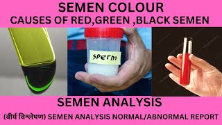 WHAT IS NORMAL SEMEN COLOURAPPERANCEBLOOD IN SEMENYELLOWGREEN BLACK PINK BROWN COLOUR SEMEN [upl. by Shulman]