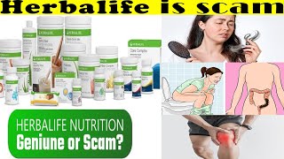 Dhruv Rathee Exposes Herbalife [upl. by Yhtak]