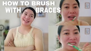 HOW TO BRUSH WITH BRACE BRACES UPDATE AFTER 2ND ADJUSTMENT [upl. by Osnola964]