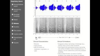 Chest Auscultation  Clinical Examination [upl. by Milinda]