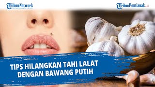 TIPS Hilangkan Tahi Lalat dengan Bawang Putih [upl. by Anitsyrhk]