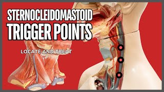 Understanding Trigger Points in the Sternocleidomastoid Muscle [upl. by Nedia]