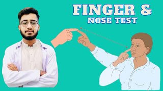 Finger Nose Test For cerebellar Ataxia Examination PhysioMentor [upl. by Anwadal157]