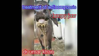 treatment of actinomycosis l symptoms of actinomycosis l dr umar khan [upl. by Ilrahc]