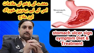 Stomach ulcers stomach ulcer symptoms stomach ulcer treatment in Urdumaide ke Dard ka ilaj [upl. by Appel106]