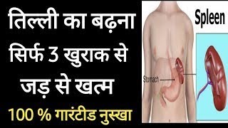 😯😯तिल्ली बडना सिर्फ 3 खुराक मे जड़ से खत्म 😳😳 Only Theery Dose Spleen size Normal 😳😳 [upl. by Argile842]