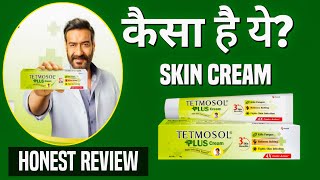 Tetmosol Plus Cream  Terbinafine Cream For Fungal Infection In Private Part  Itching Solution [upl. by Eissirc]