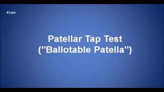 Patellar Tap test Ballotable Patella [upl. by Andrew]