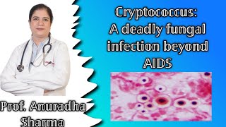 Cryptococcus A Deadly Fungal Infection Beyond AIDS Cryptococcosis  Cryptococcal meningitis [upl. by Selina]