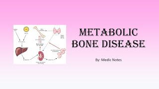 Metabolic bone disease  ricketsosteomalacia Pagets disease osteoporosis [upl. by Adlai]