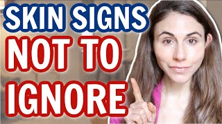 7 SKIN SIGNS NOT TO IGNORE 😮 DERMATOLOGIST DrDrayzday [upl. by Alicul]