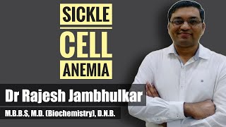 Sickle cell anemia [upl. by Prue415]