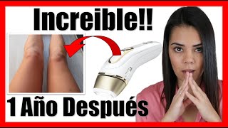 💆 Depilación IPL en CASA 💆 Braun silk expert pro 5 EXPERIENCIA eliminación vello 1 AÑO después [upl. by Bordy]