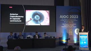 AIOC2023 IC233 topic DR SUNIL GANEKAL CAPSULAR CONTRACTURE AND CAPSULAR DISTENSION SYNDROME [upl. by Nooj981]