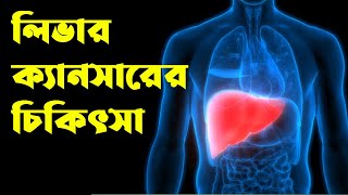 লিভার ক্যানসারের চিকিৎসা  গণস্বাস্থ্য হোমিও  01738987100 [upl. by Viridis]