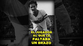 Era JUGADOR y le FALTABA un BRAZO [upl. by Attiuqahs]