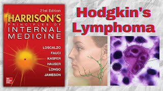 HODGKINS LYMPHOMA  Presentation  Diagnosis  Staging  Treatment  Harrison [upl. by Benzel]