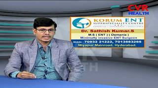 What Is Synostosis Causes Of synostosis Symptoms amp Treatment  Dr Sathish Kumar  Korum ENT CVR [upl. by Schurman]