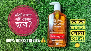 Neutrogena OilFree Acne Wash Review  এটি কাদের জন্য Recommended Oily Skin এর জন্য কেমন হবে🤔 [upl. by Htabmas]