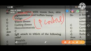 How to Differentiate Between Cushing Disease Vs Cushing SyndromeDrjehangirkhan fcps1mbbs [upl. by Artimed50]