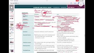 Movement disorder  Akathisia asterixis Athetosischorea  neurology 113  First Aid USMLE [upl. by Gerald]