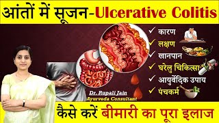 आँतों में सूजन घाव Ulcerative Colitis अल्सरेटिव कोलाइटिस Ayurvedic Treatment amp Diet Planhealth [upl. by Atsyrhc]