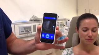 How to use an iPhone Otoscope [upl. by Joost543]