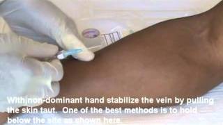 IV Insertion Video Demo 1 of 2mp4 [upl. by Cami]