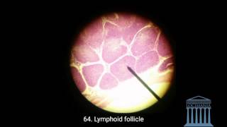 Histology  Vermiform Appendix [upl. by Rettig362]