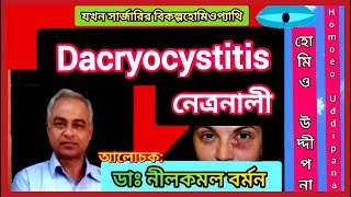 Dacryocystitis  নেত্রনালী  যখন সার্জারির বিকল্প হোমিওপ্যাথি  পর্ব ৭  Part 7  ডাঃ নীলকমল বর্মন [upl. by Carroll]