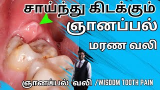 ஞானப்பல் வலி குறைய2024𝐖𝐢𝐬𝐝𝐨𝐦 𝐭𝐨𝐨𝐭𝐡 𝐏𝐚𝐢𝐧 𝐢𝐧 𝐓𝐚𝐦𝐢𝐥Tooth pain relief in tamilkadava pallu pain [upl. by Walsh]