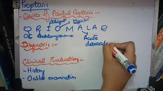 PROPTOSIS very important topic with MNEMONICS to learn part 2 [upl. by Jeffy]