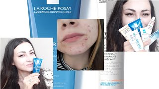 La Roche Posay Effaclar Set Kullandım  Sonuç MÜKEMMEL  🧖🏻‍♀️ [upl. by Alket958]