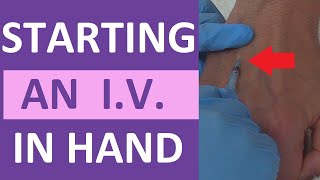 How to Start an IV  IV Catheter Insertion amp Flush Technique in Hand  Nursing Skill [upl. by Corson26]