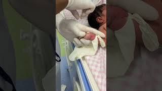 Como CANALIZAR a Un Neonato  Prácticas De Enfermería  enfermeria bebe neonatal [upl. by Edahs726]