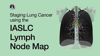 Staging Lung Cancer using the IASLC Lymph Node Map [upl. by Domenech]