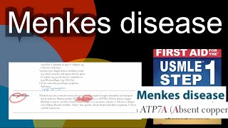 Menkes disease  ATP7A defect so copper deficiency in HindiUrdu by first aid for USMLE step 1 [upl. by Anniroc]