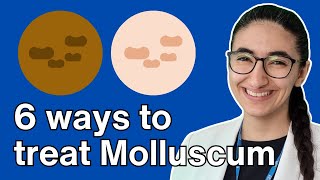 How to treat molluscum contagiosum with Pharmacist Virginia [upl. by Noeruat]