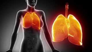 Pneumonia 3D Animation SD [upl. by Annairt]